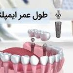 طول عمرایمپلنت دندان | کارت تخفیف دندانپزشکی بنیان مهام